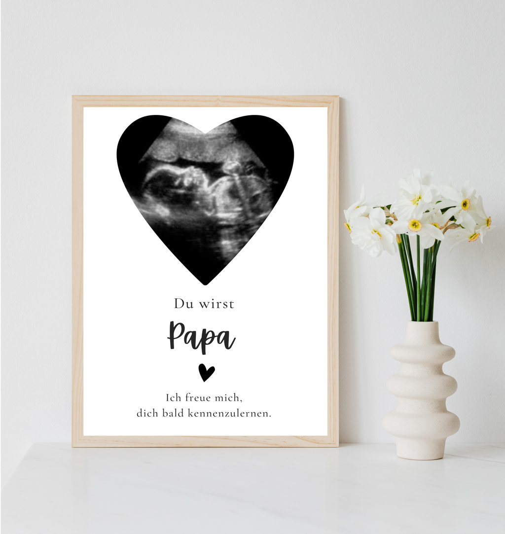 Poster Ultraschallbild personalisiert | Schwangerschaft verkünden als PDF Datei, ausgedruckt A4 oder mit Premium Bilderrahmen