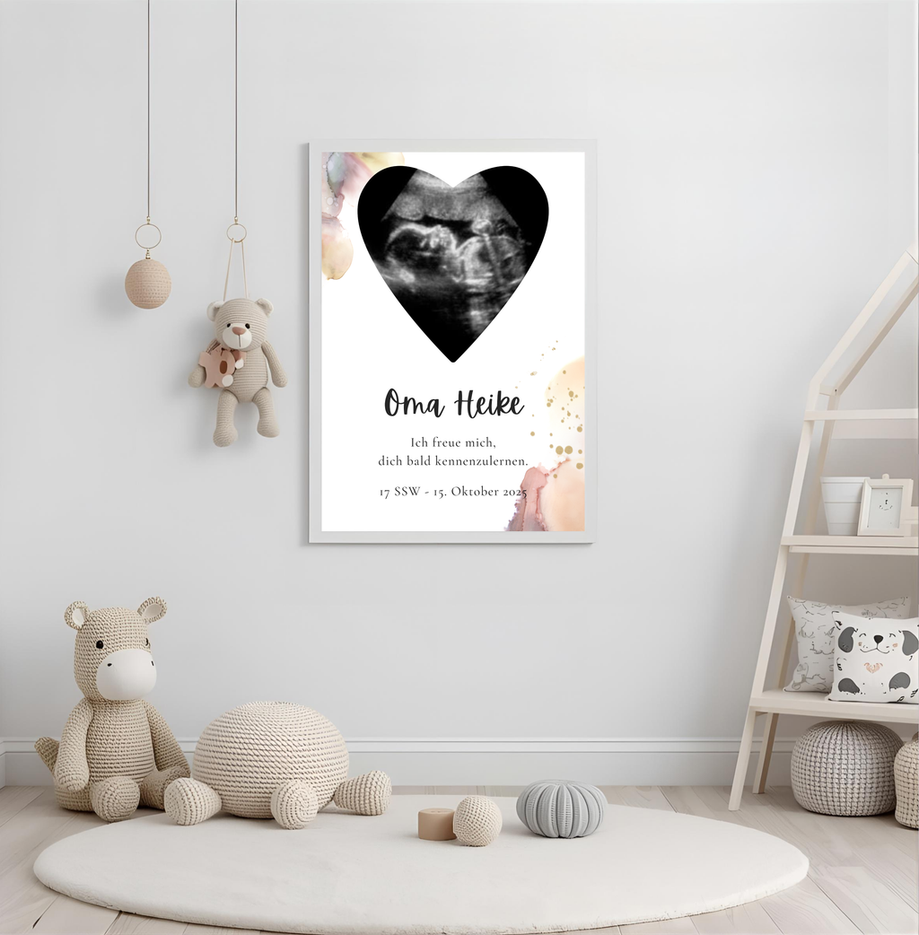 Poster Ultraschallbild personalisiert  | Schwangerschaft verkünden als PDF Datei, ausgedruckt in A4 oder mit Premium Bilderrahmen