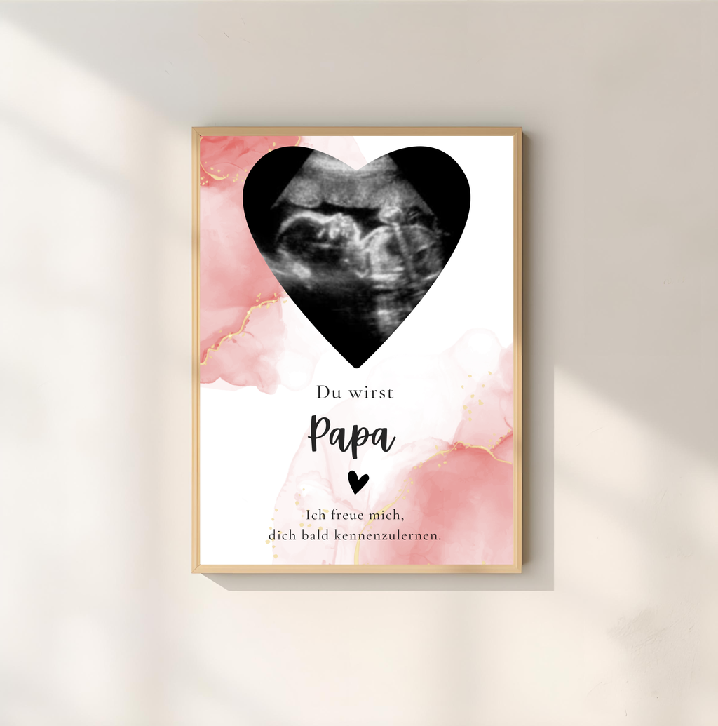 Poster Ultraschallbild personalisiert | Schwangerschaft verkünden als PDF Datei, ausgedruckt A4 oder mit Premium Bilderrahmen