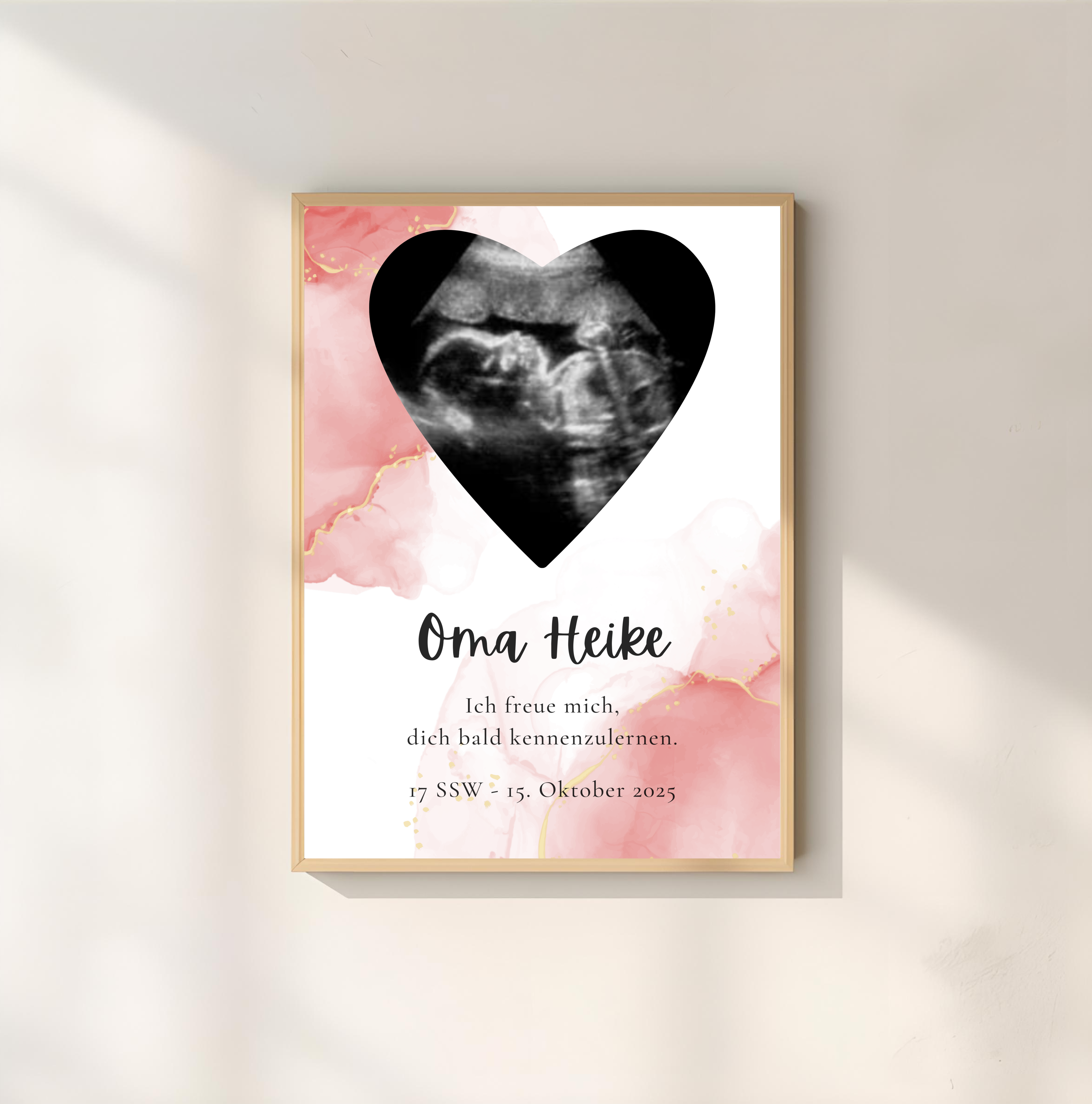 Poster Ultraschallbild personalisiert  | Schwangerschaft verkünden als PDF Datei, ausgedruckt in A4 oder mit Premium Bilderrahmen