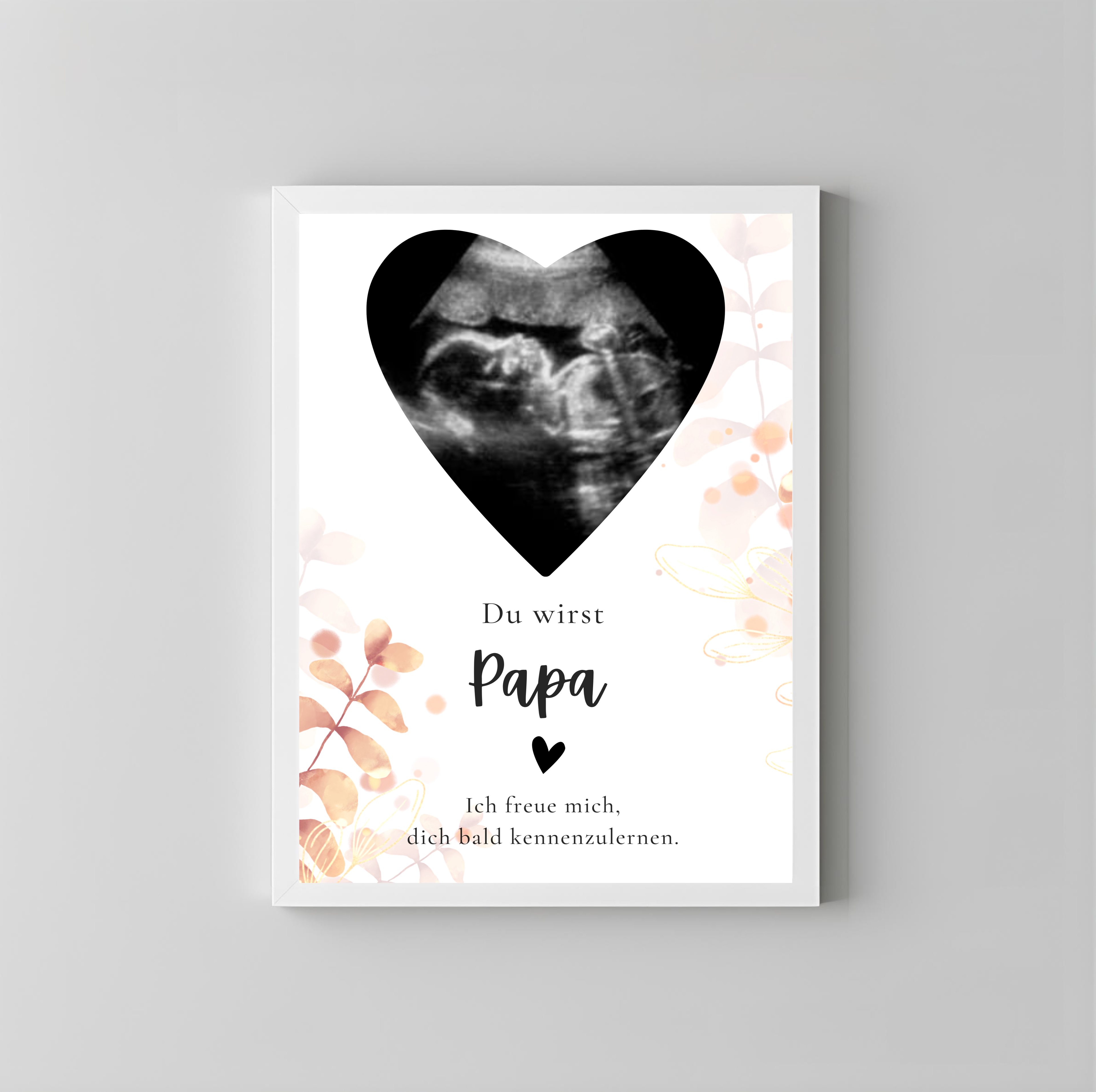 Poster Ultraschallbild personalisiert | Schwangerschaft verkünden als PDF Datei, ausgedruckt A4 oder mit Premium Bilderrahmen